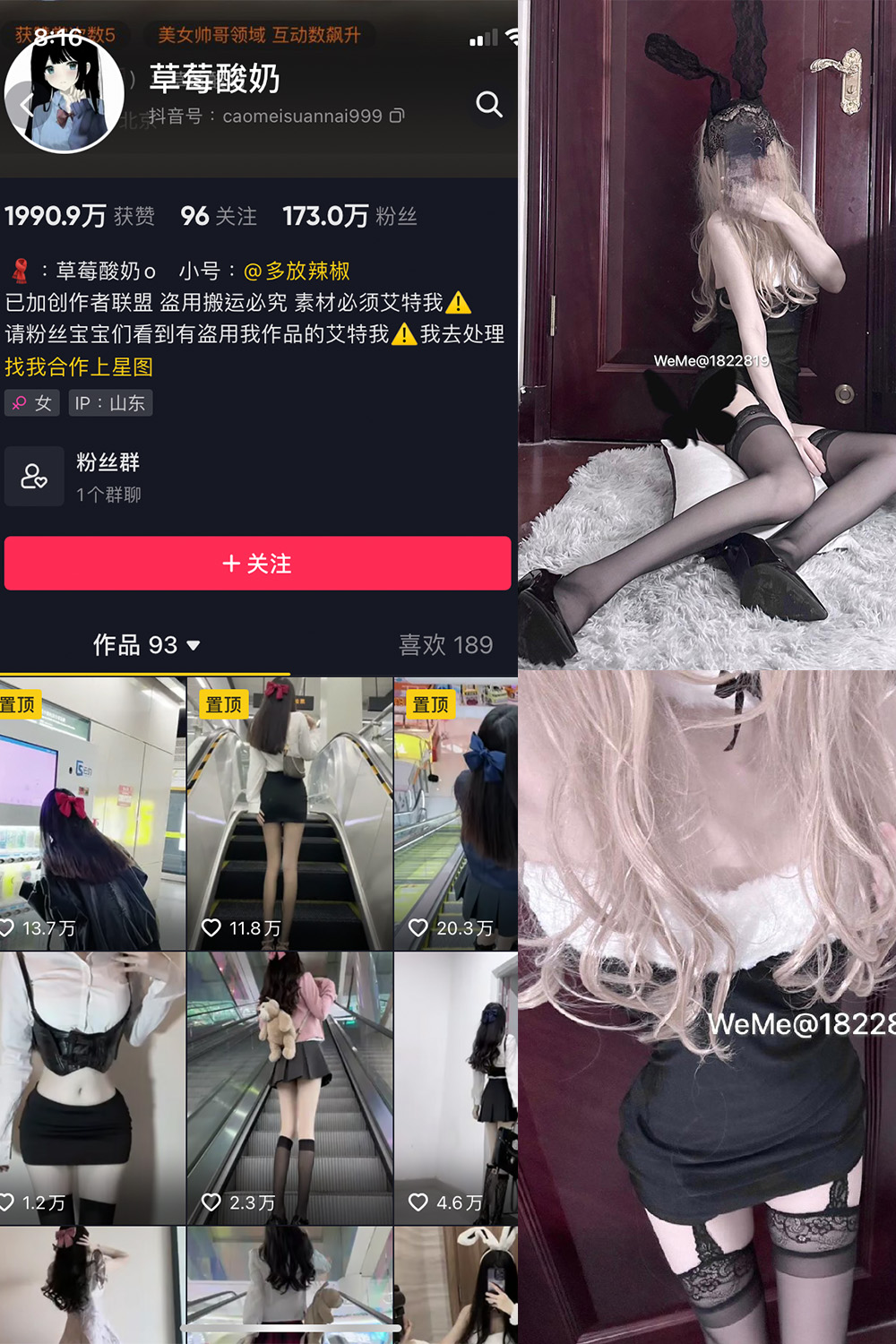 抖音 草莓酸奶 微密圈  NO.025期 【21P】